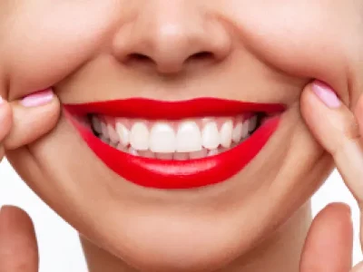 Cosmetic Dentistry