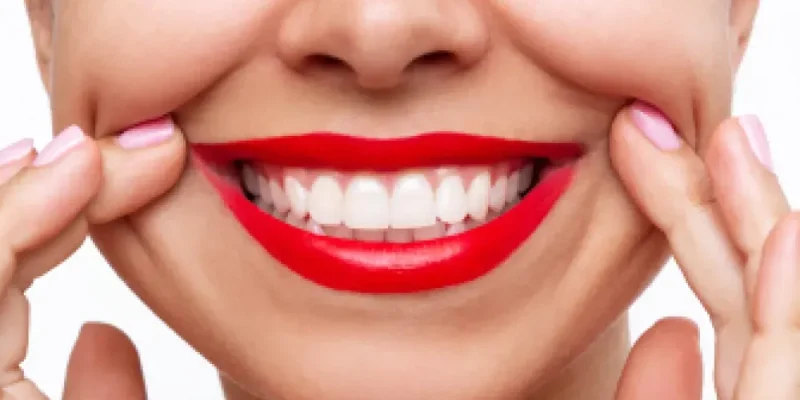 Cosmetic Dentistry