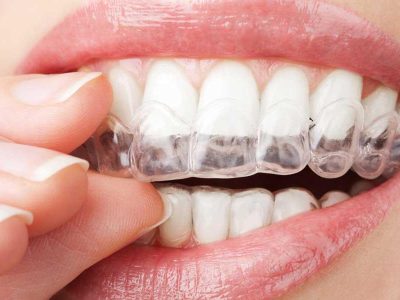 3D Printing In Cosmetic Dentistry