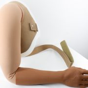 upper extremity prosthetics