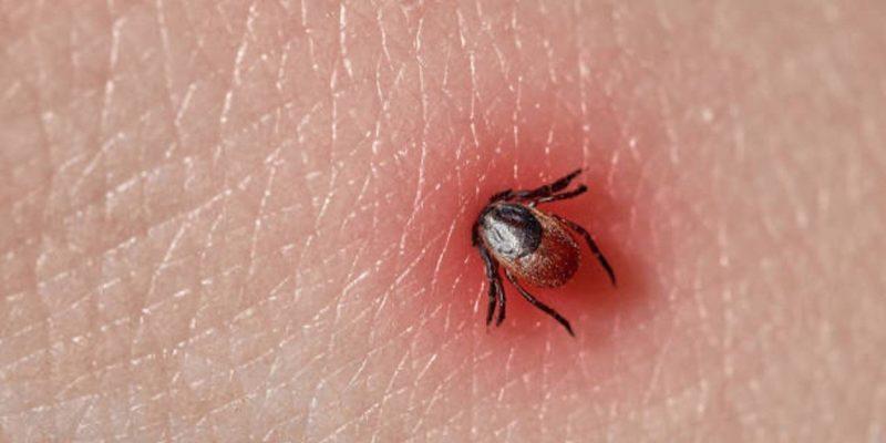 Lyme Disease